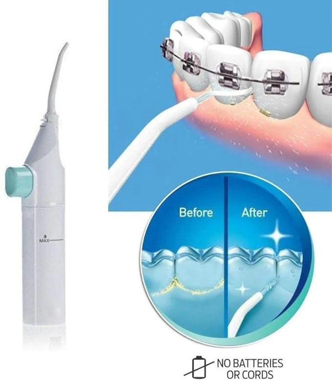H2O Oral Irrigator ©